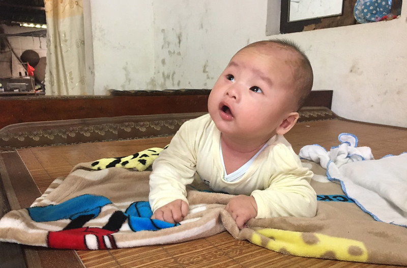 Caritas Hà Nội: Giúp đỡ bệnh nhân tim bẩm sinh