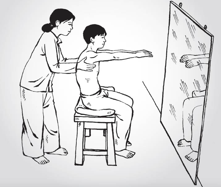 Phục hồi chức năng tổn thương tuỷ sống