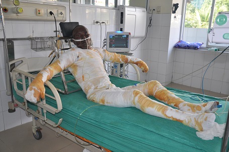 Caritas Bùi Chu thăm những bệnh nhân bỏng do vụ nổ tàu ngày 02.10